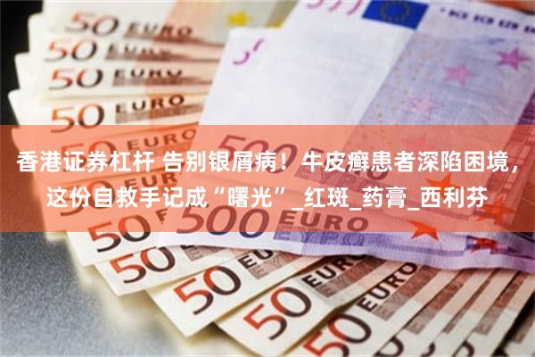 香港证券杠杆 告别银屑病！牛皮癣患者深陷困境，这份自救手记成“曙光”_红斑_药膏_西利芬
